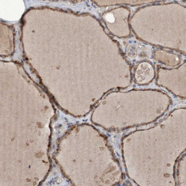 PHYH Antibody in Immunohistochemistry (Paraffin) (IHC (P))