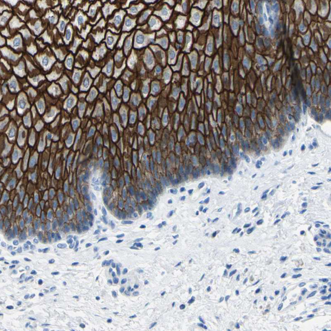 Desmocollin 2 Antibody in Immunohistochemistry (Paraffin) (IHC (P))