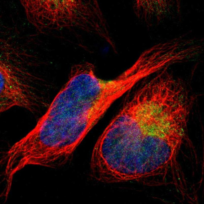 ACSL1 Antibody in Immunocytochemistry (ICC/IF)