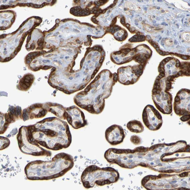 GCS1 Antibody in Immunohistochemistry (Paraffin) (IHC (P))