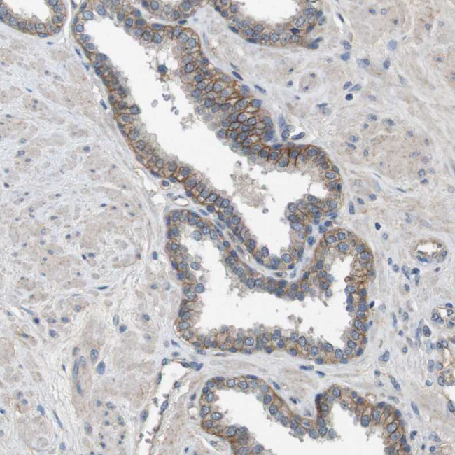 CD155 Antibody in Immunohistochemistry (Paraffin) (IHC (P))