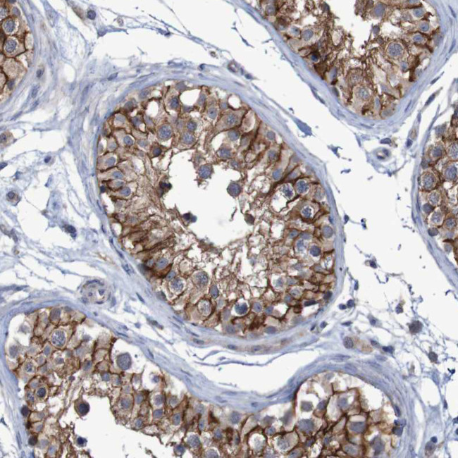 Nectin 2 Antibody in Immunohistochemistry (Paraffin) (IHC (P))