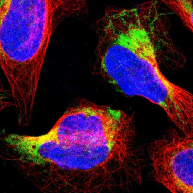 Bit1 Antibody in Immunocytochemistry (ICC/IF)