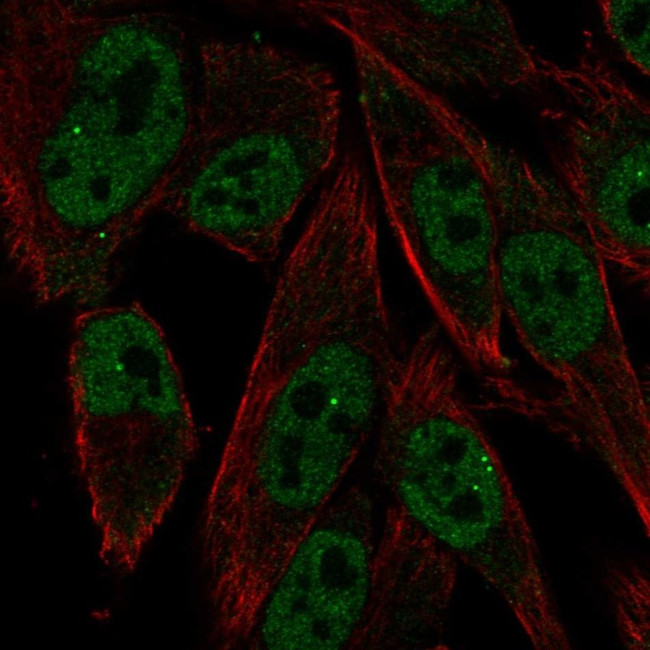 RXRG Antibody in Immunocytochemistry (ICC/IF)