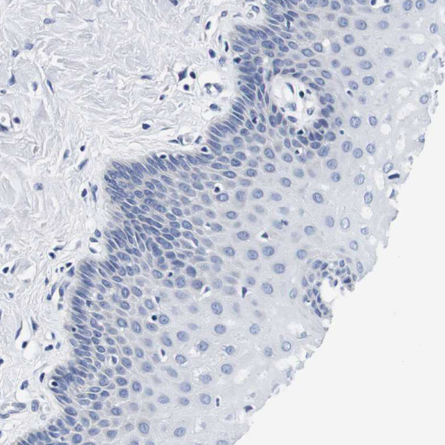 CD42b Antibody in Immunohistochemistry (Paraffin) (IHC (P))