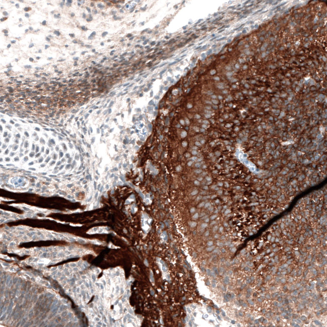 ROBO2 Antibody in Immunohistochemistry (Paraffin) (IHC (P))