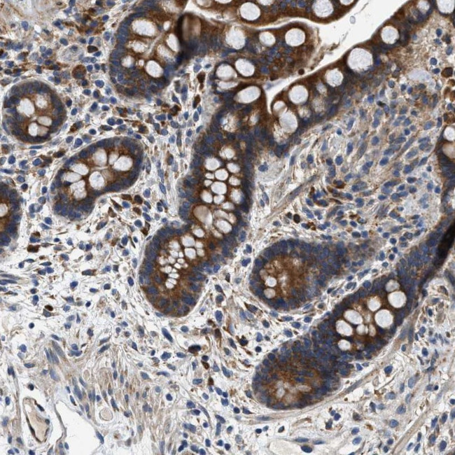 PLD2 Antibody in Immunohistochemistry (Paraffin) (IHC (P))