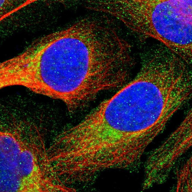 Annexin A3 Antibody in Immunocytochemistry (ICC/IF)