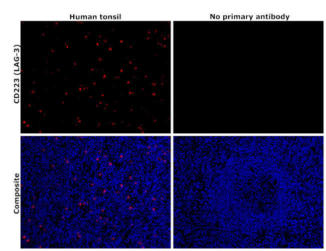 CD223 Antibody in Immunohistochemistry (Paraffin) (IHC (P))