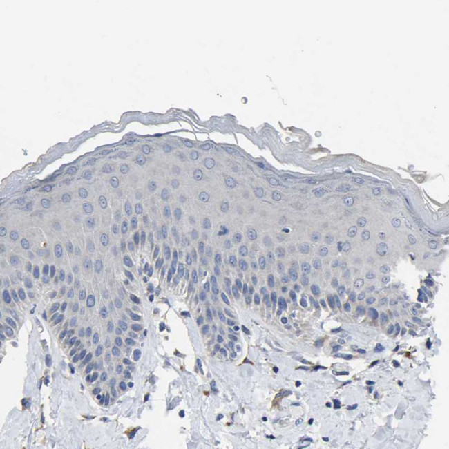 CYP2C8 Antibody in Immunohistochemistry (Paraffin) (IHC (P))