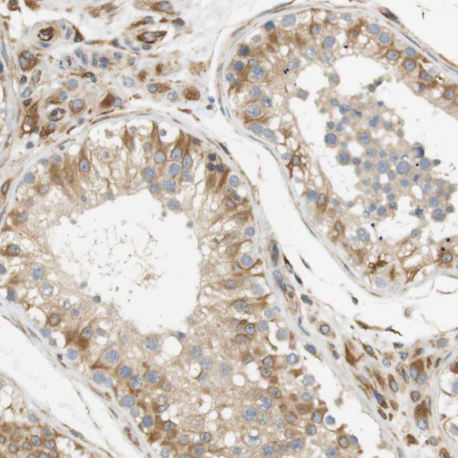 Cytohesin 3 Antibody in Immunohistochemistry (Paraffin) (IHC (P))