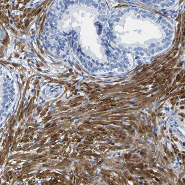 Calponin 1 Antibody in Immunohistochemistry (Paraffin) (IHC (P))