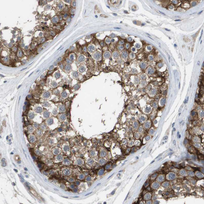 MARCH8 Antibody in Immunohistochemistry (Paraffin) (IHC (P))