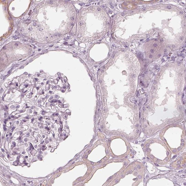 PON3 Antibody in Immunohistochemistry (Paraffin) (IHC (P))