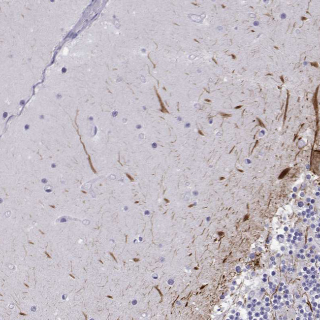 NEFL Antibody in Immunohistochemistry (Paraffin) (IHC (P))