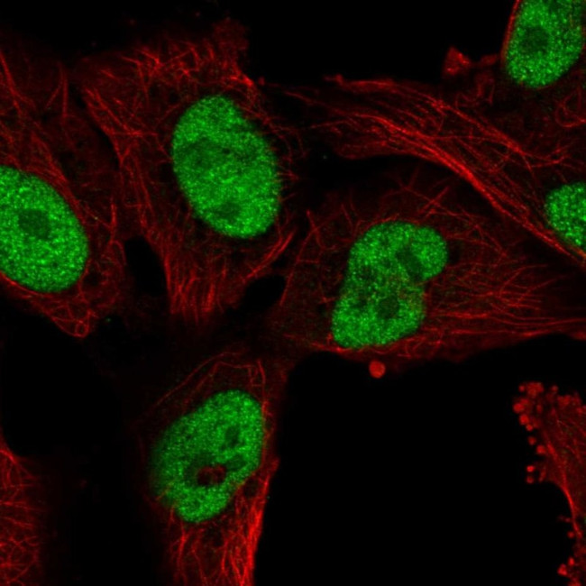 PTPN2 Antibody in Immunocytochemistry (ICC/IF)