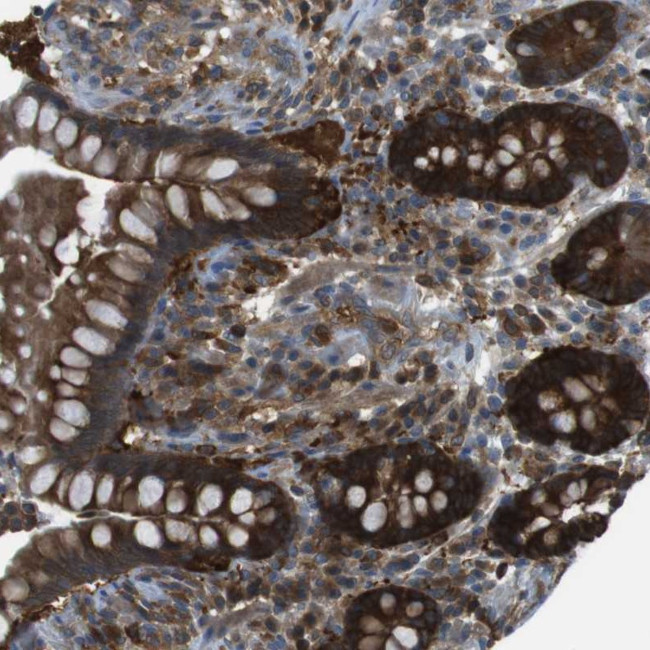 MTHFD1 Antibody in Immunohistochemistry (Paraffin) (IHC (P))