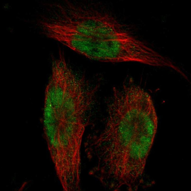 BRD4 Antibody in Immunocytochemistry (ICC/IF)