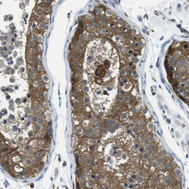 LOK Antibody in Immunohistochemistry (Paraffin) (IHC (P))