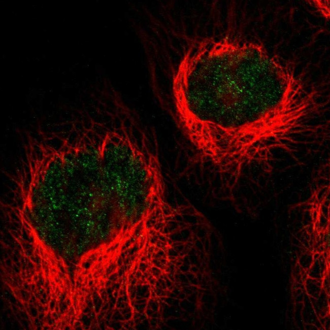 HLTF Antibody in Immunocytochemistry (ICC/IF)