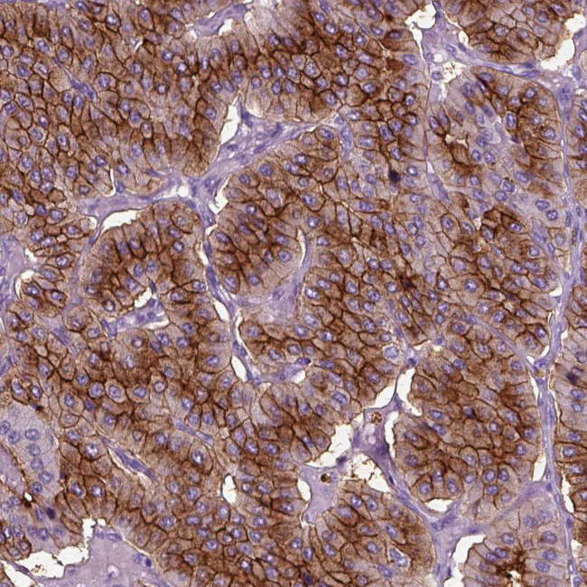 CD109 Antibody in Immunohistochemistry (Paraffin) (IHC (P))