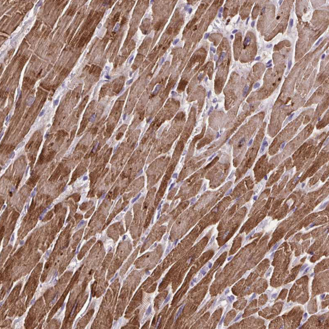 Cardiac Troponin T Antibody in Immunohistochemistry (Paraffin) (IHC (P))