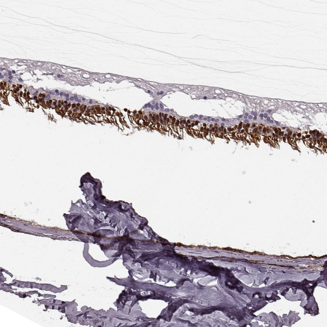 Recoverin Antibody in Immunohistochemistry (Paraffin) (IHC (P))