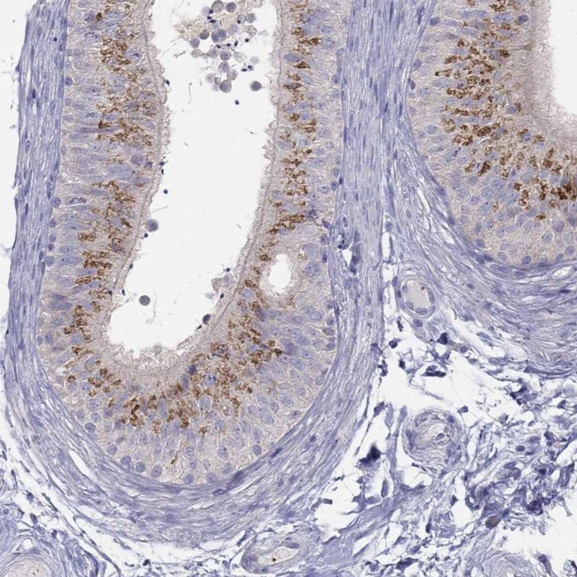 MGAT4C Antibody in Immunohistochemistry (Paraffin) (IHC (P))