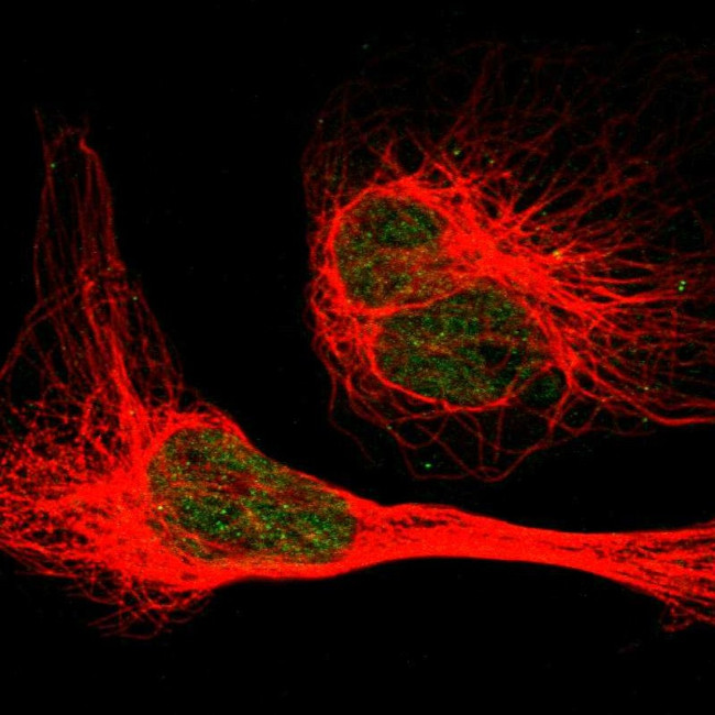 HRI Antibody in Immunocytochemistry (ICC/IF)