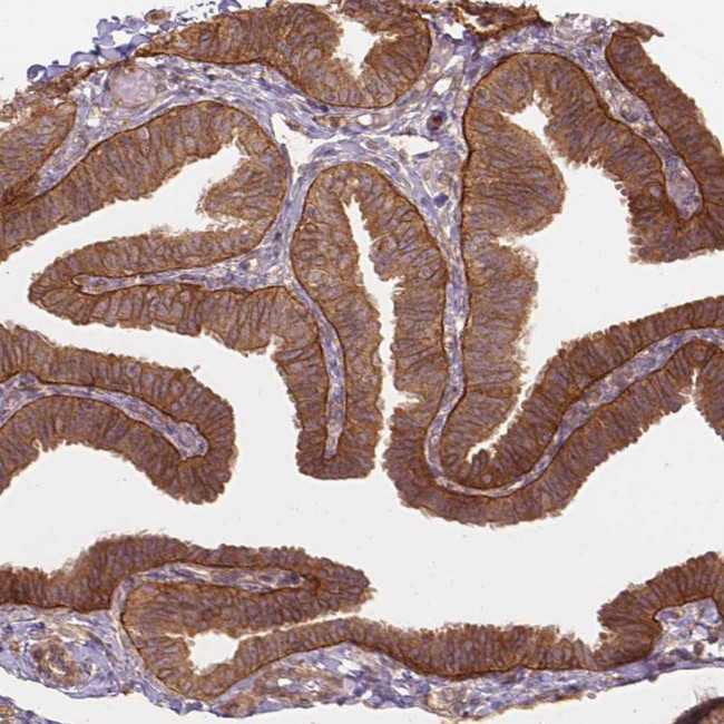 XPR1 Antibody in Immunohistochemistry (Paraffin) (IHC (P))