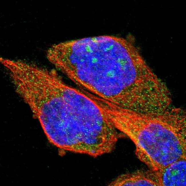 PPM1B Antibody in Immunocytochemistry (ICC/IF)