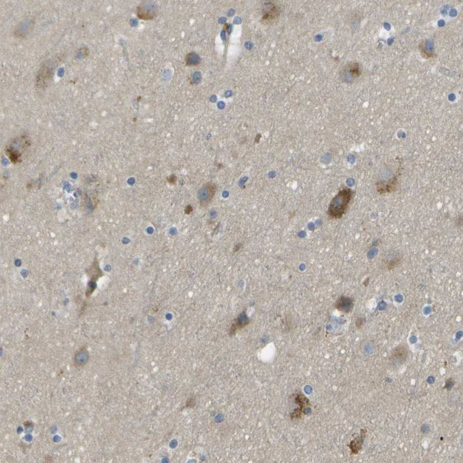 LIPG Antibody in Immunohistochemistry (Paraffin) (IHC (P))