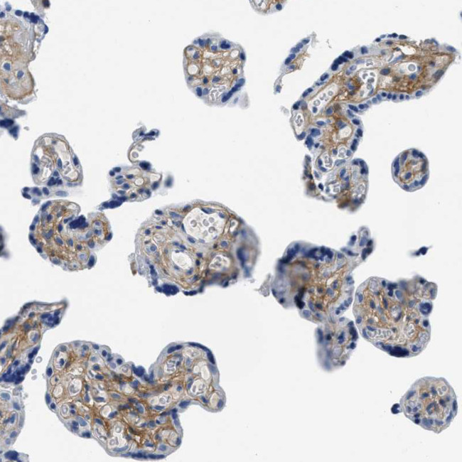 TGFBI Antibody in Immunohistochemistry (Paraffin) (IHC (P))