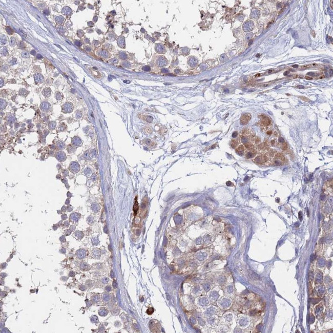 Bi-1 Antibody in Immunohistochemistry (Paraffin) (IHC (P))