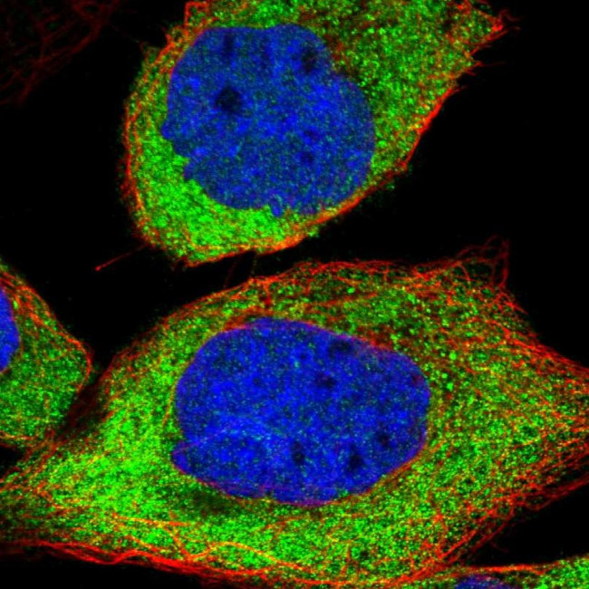 CaMKK beta Antibody in Immunocytochemistry (ICC/IF)