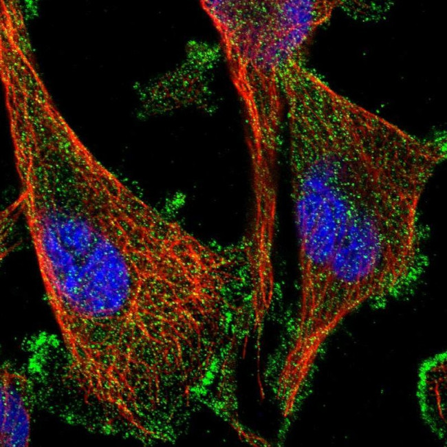 AAK1 Antibody in Immunocytochemistry (ICC/IF)