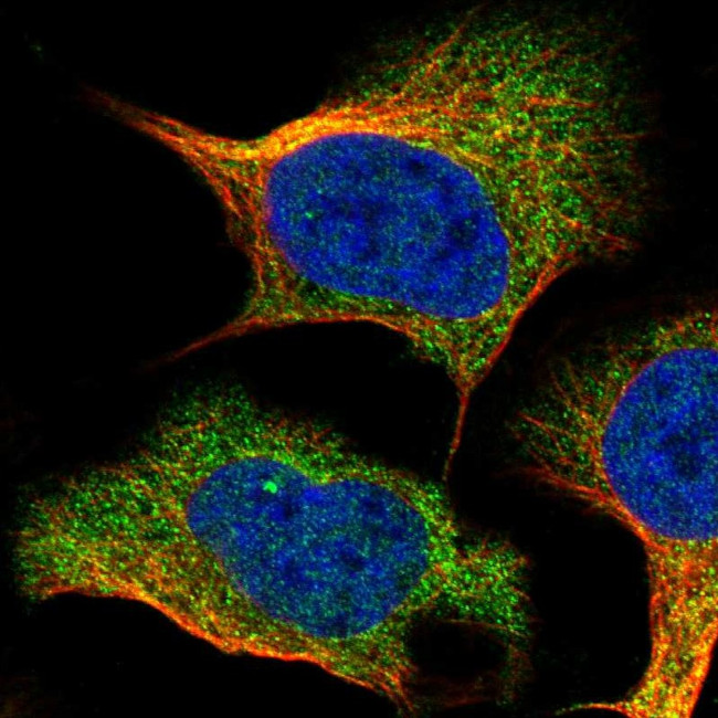 IFNAR1 Antibody in Immunocytochemistry (ICC/IF)