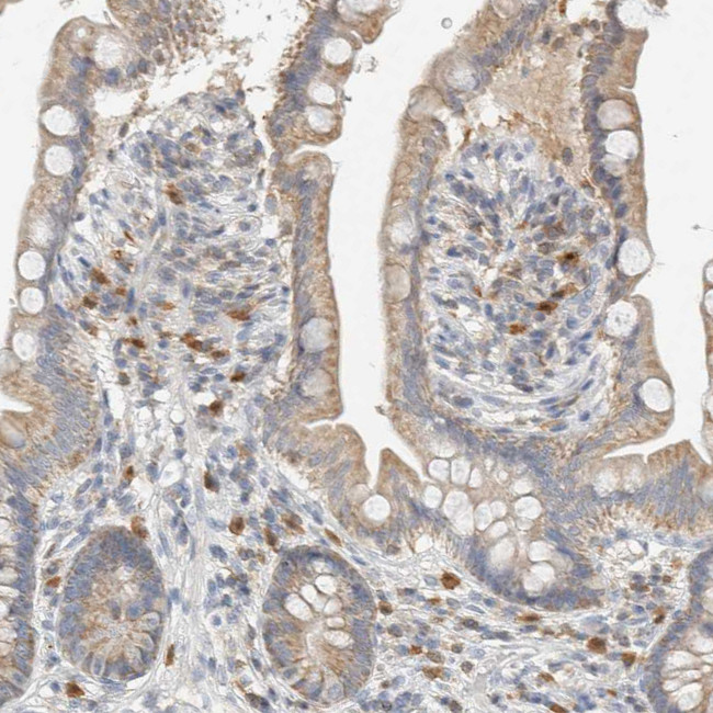 CAPG Antibody in Immunohistochemistry (Paraffin) (IHC (P))