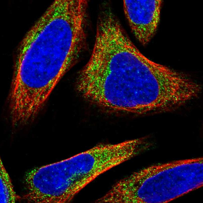 NADE Antibody in Immunocytochemistry (ICC/IF)