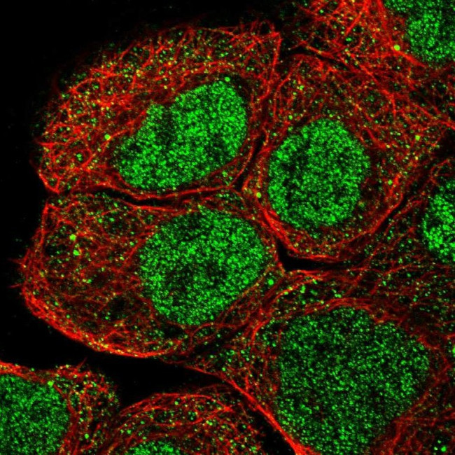 RNF12 Antibody in Immunocytochemistry (ICC/IF)