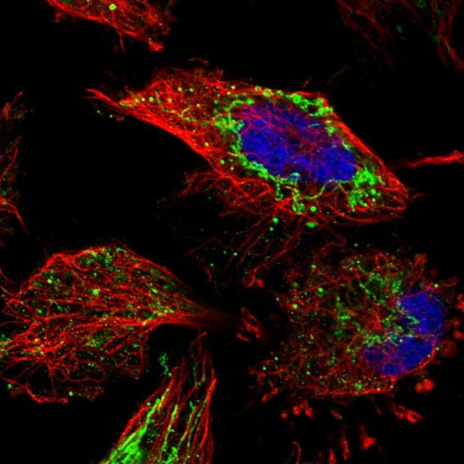 ETFB Antibody in Immunocytochemistry (ICC/IF)