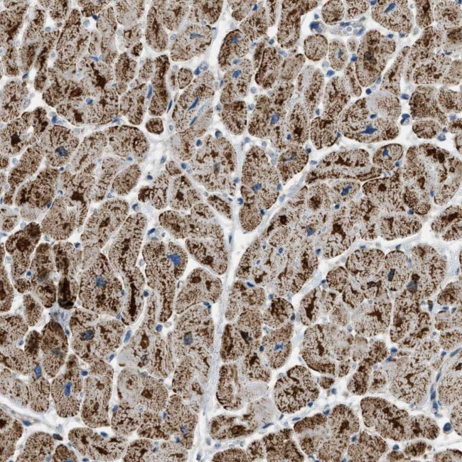 ETFB Antibody in Immunohistochemistry (Paraffin) (IHC (P))