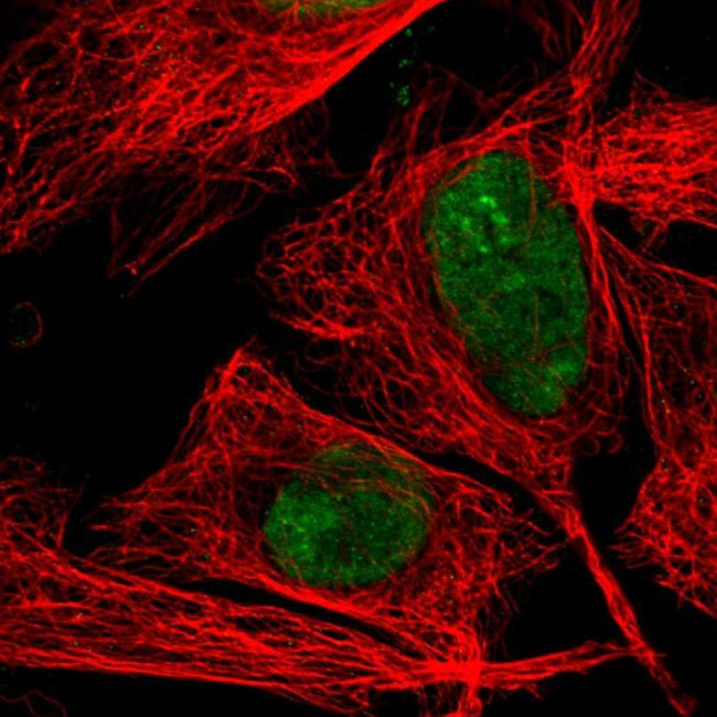 TOP1 Antibody in Immunocytochemistry (ICC/IF)