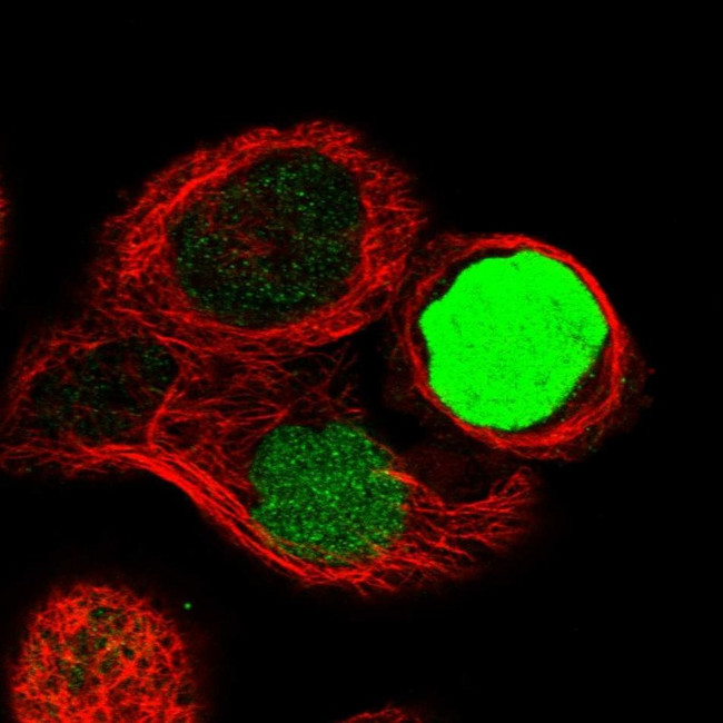 CAPG Antibody in Immunocytochemistry (ICC/IF)