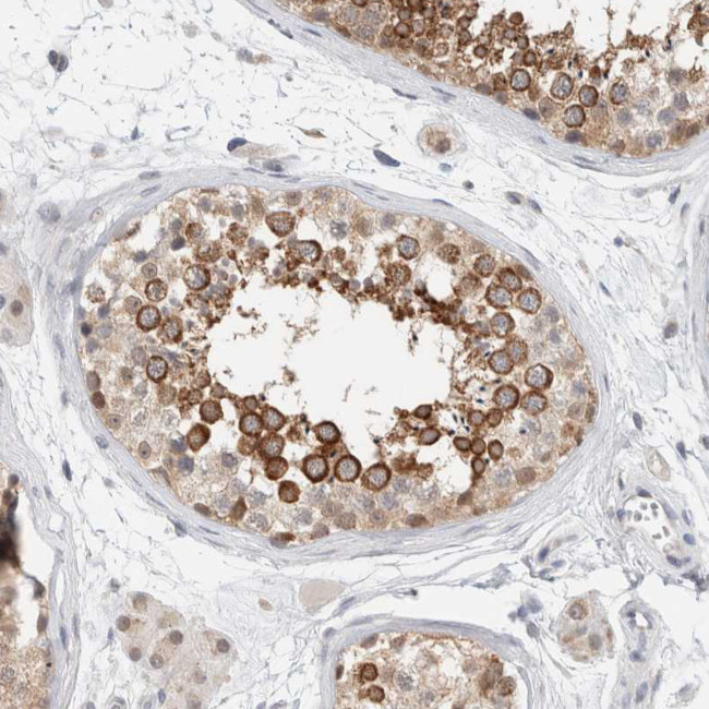 CAT1 Antibody in Immunohistochemistry (Paraffin) (IHC (P))