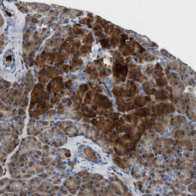 SLIT2 Antibody in Immunohistochemistry (Paraffin) (IHC (P))