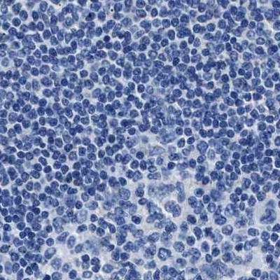 AMACR Antibody in Immunohistochemistry (Paraffin) (IHC (P))