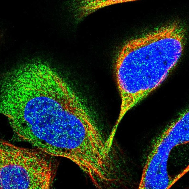 RBKS Antibody in Immunocytochemistry (ICC/IF)