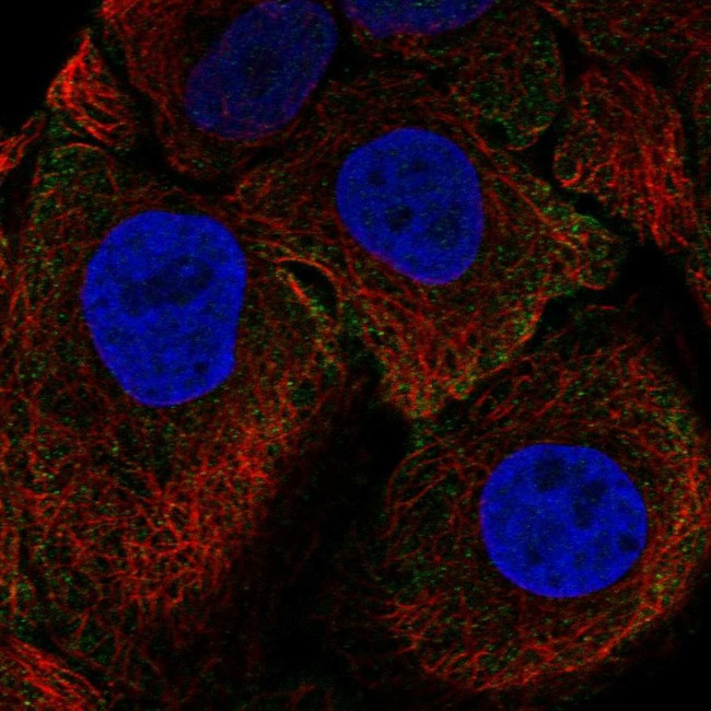 CEA Antibody in Immunocytochemistry (ICC/IF)