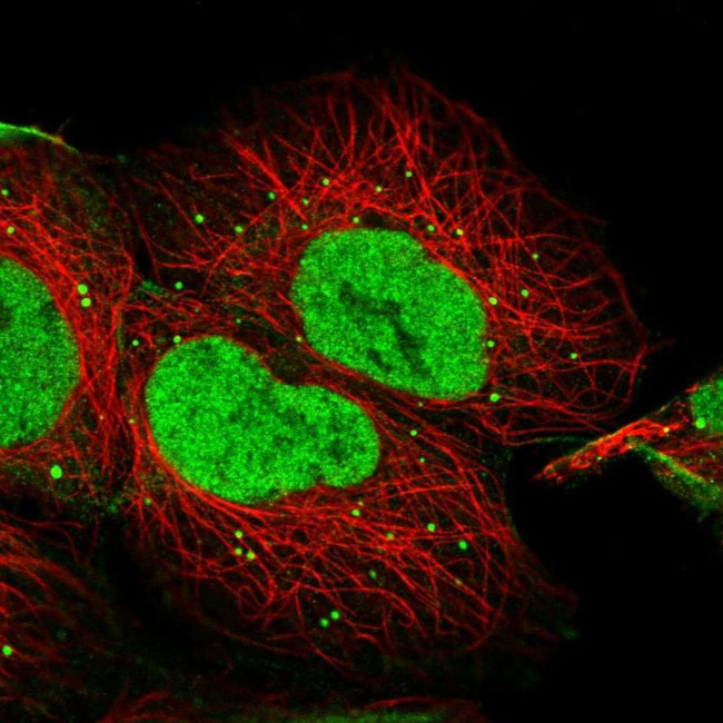 BCL7A Antibody in Immunocytochemistry (ICC/IF)